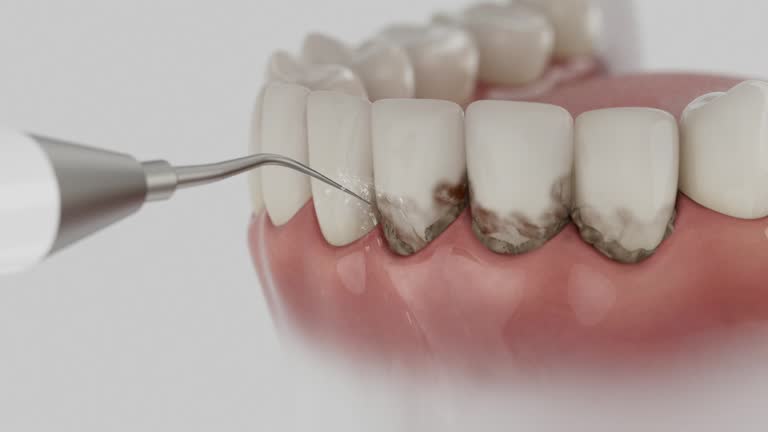 Reliable Tooth Extraction contractor in Hewitt, TX by Smile Center Dentistry